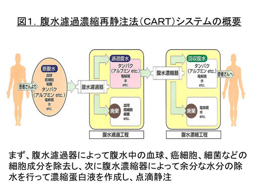 cart概要の画像